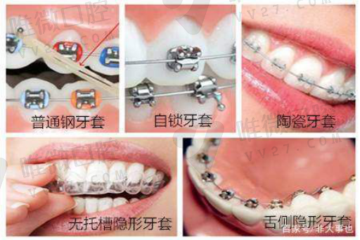 天津种植牙和假牙的区别,天津哪里种植牙好(图1)